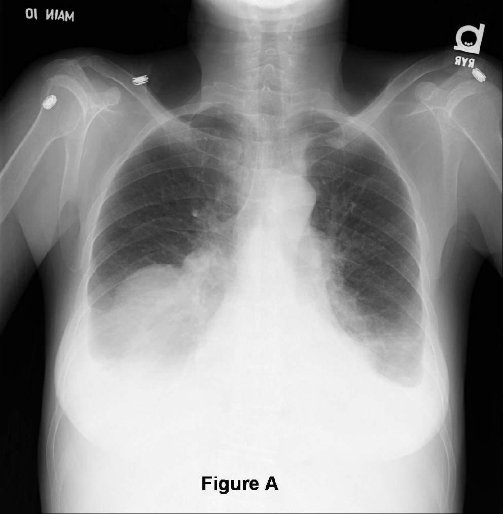 Radiograph 1 from archived case 32
