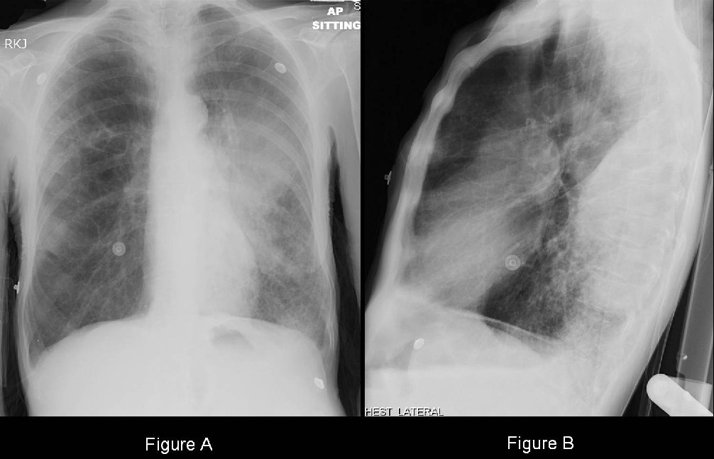 Radiograph 1 from archived case 13