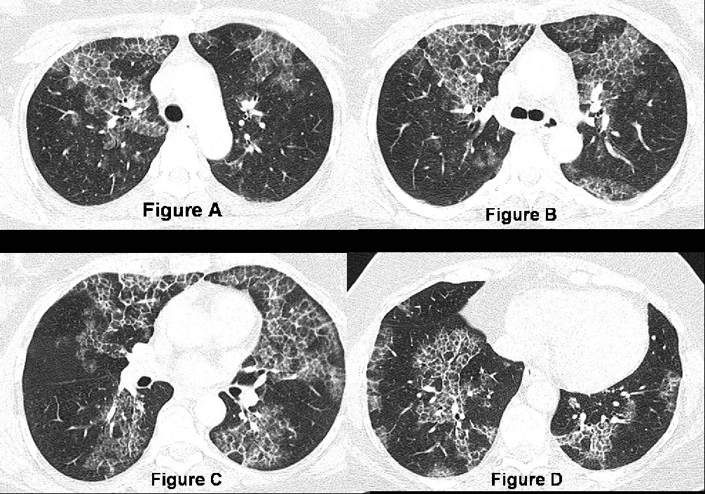 Radiograph 1 from archived case 12