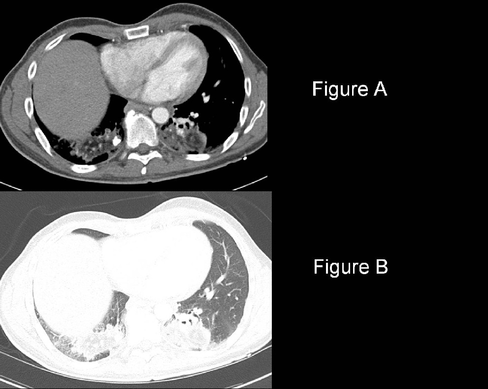 Radiograph 1 from archived case 14