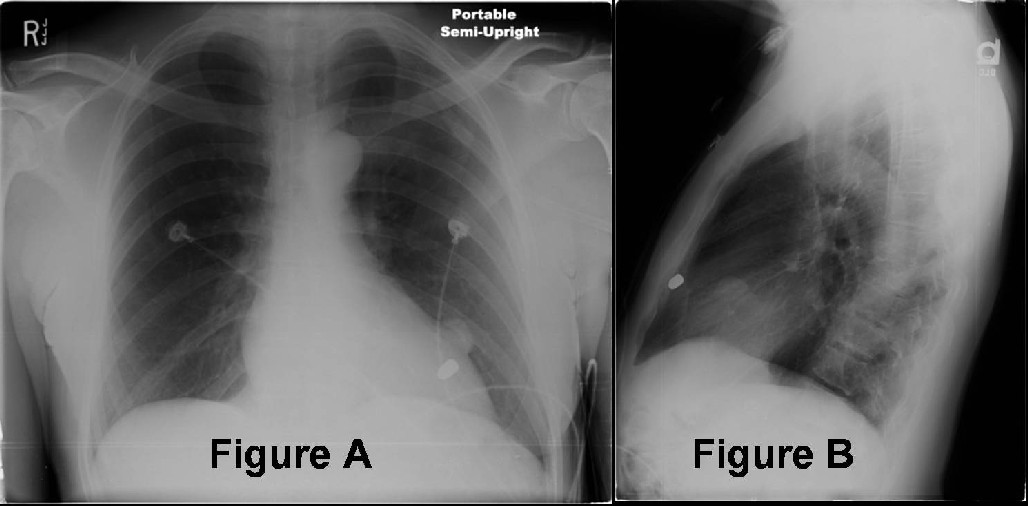 Radiograph 2 from archived case 15