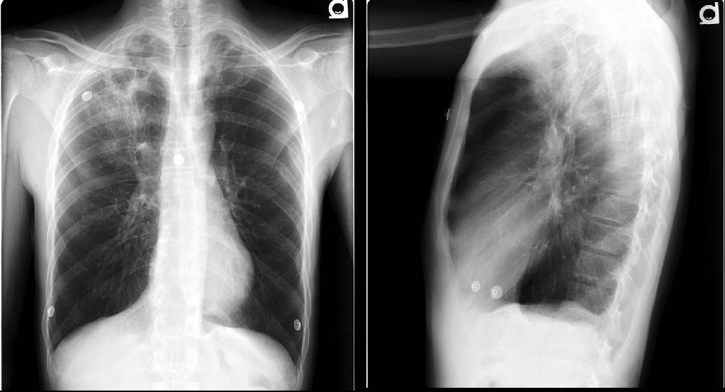 Radiograph 1 from archived case 16