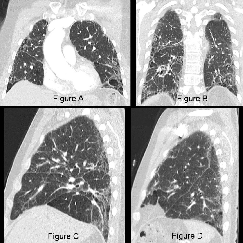 Radiograph 1 from archived case 27