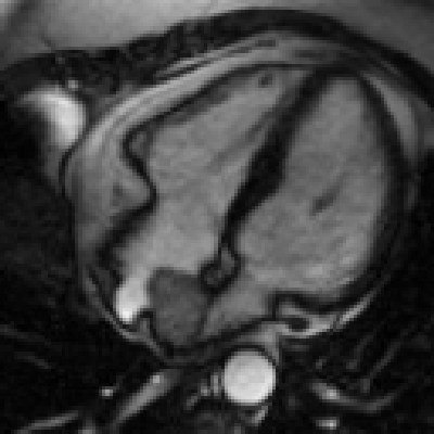 Radiograph 6 from archived case 20