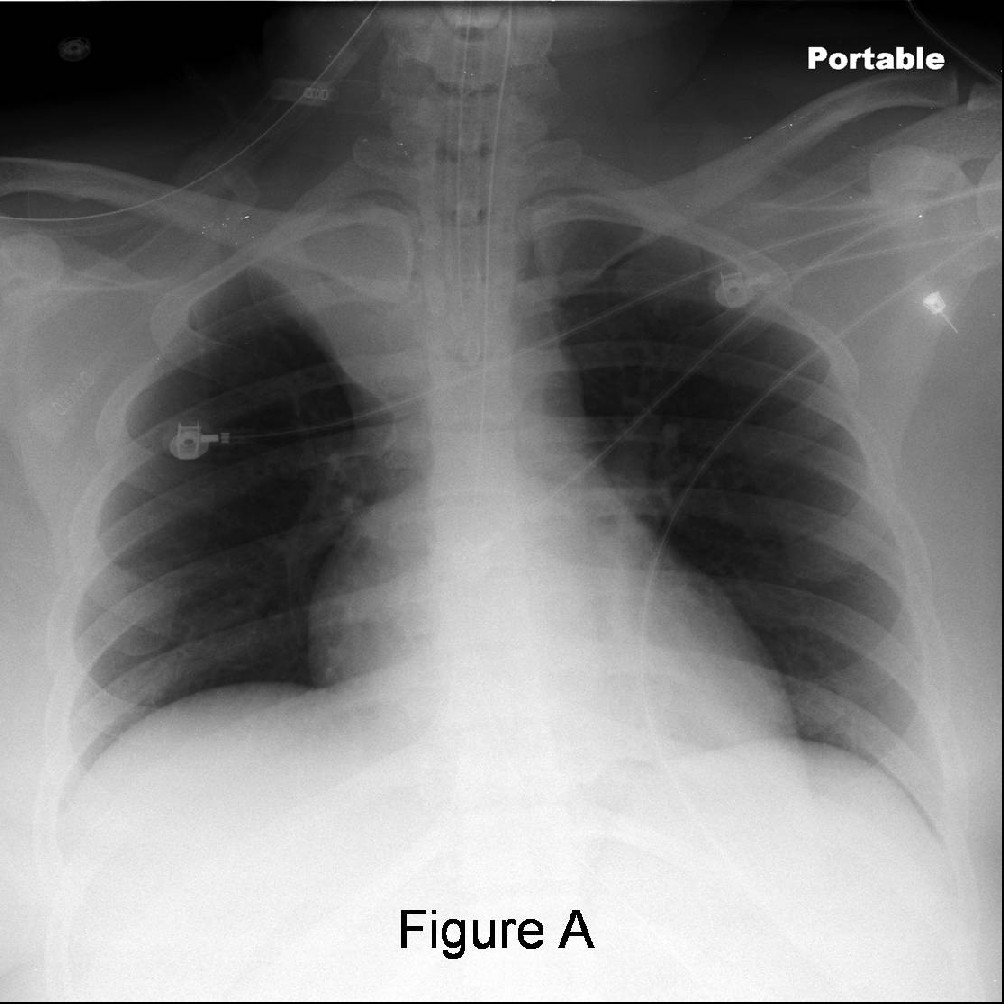 Radiograph 2 from archived case 39