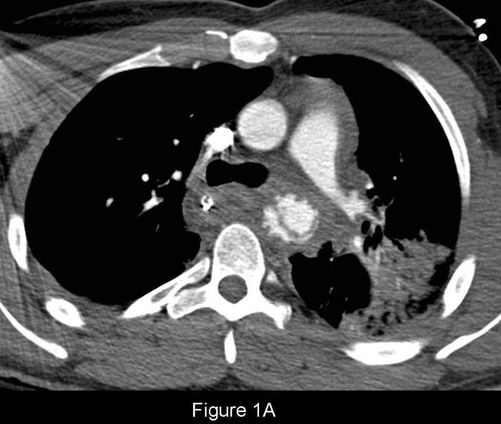 Radiograph 1 from archived case 68