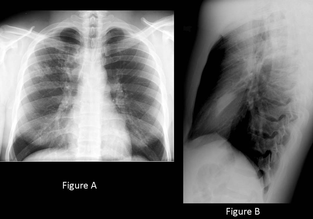Radiograph 1 from archived case 48