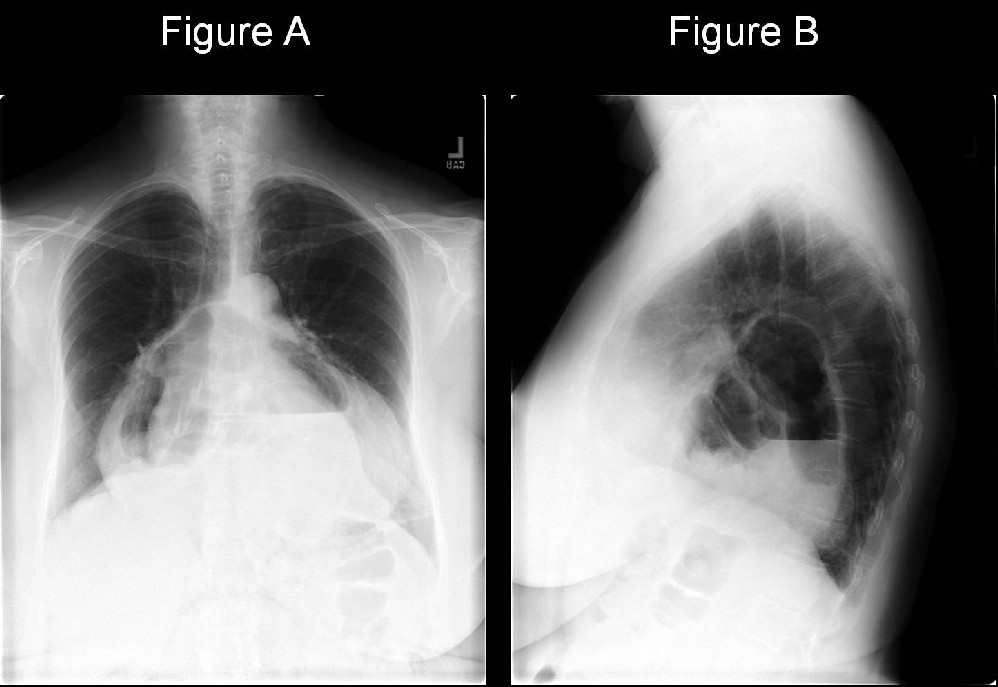 Radiograph 2 from archived case 19