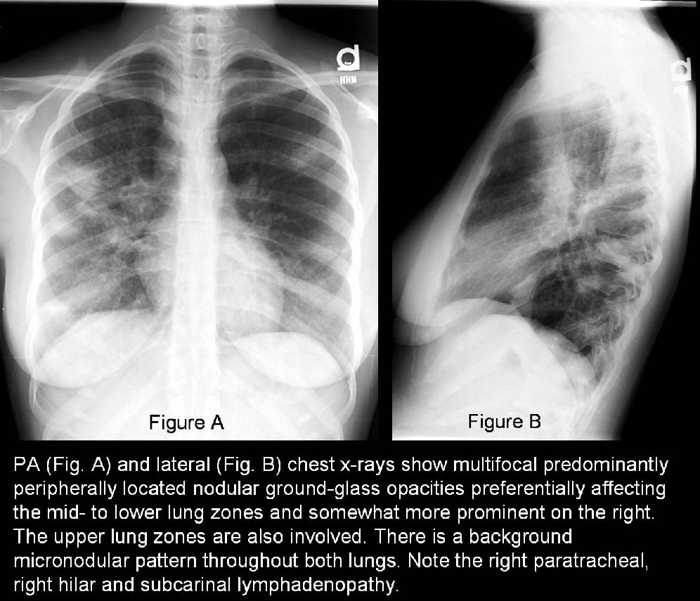 Radiograph 3 from archived case 23