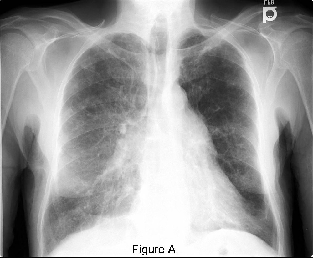Radiograph 1 from archived case 26