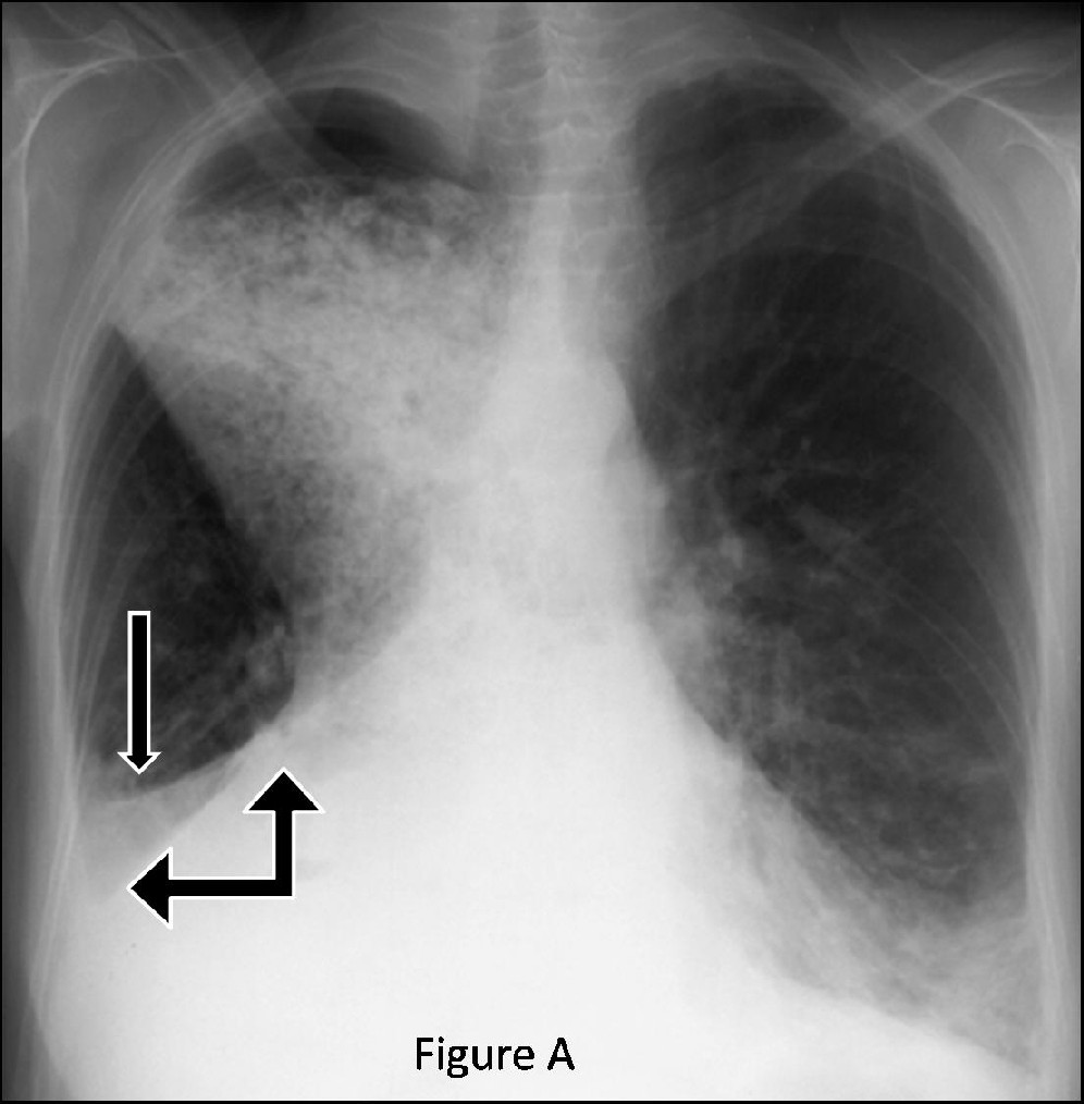 Radiograph 2 from archived case 43