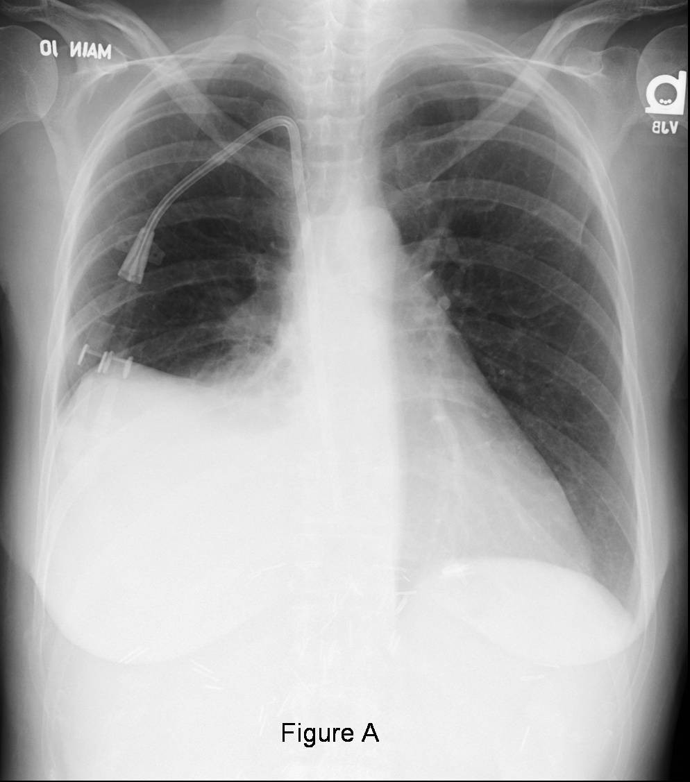 Radiograph 1 from archived case 44