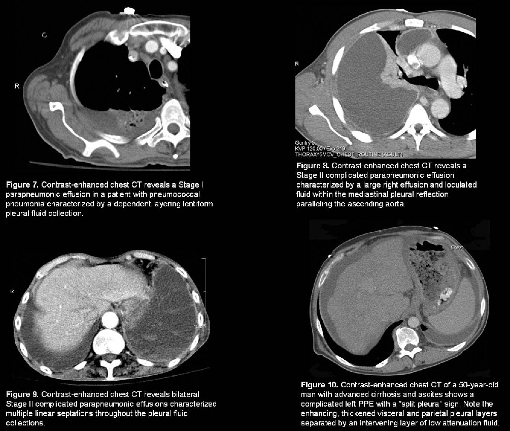 Radiograph 3 from archived case 5