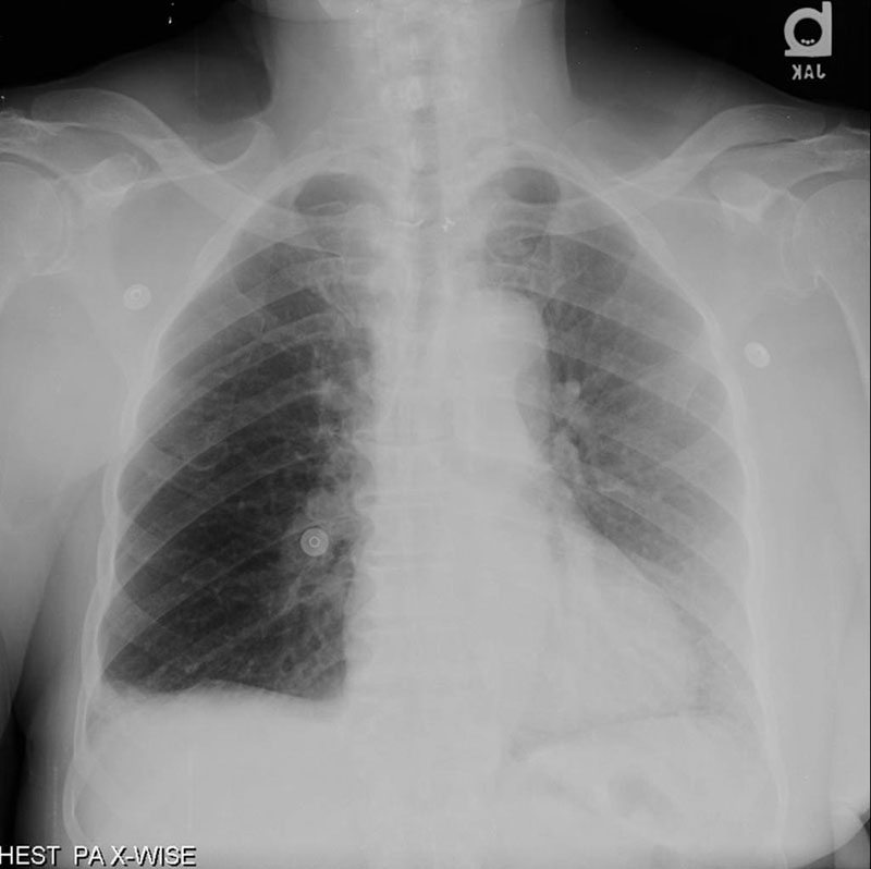Radiograph 1 from archived case 3