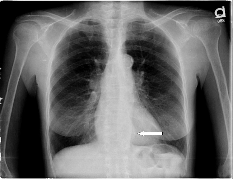 Radiograph 3 from archived case 11