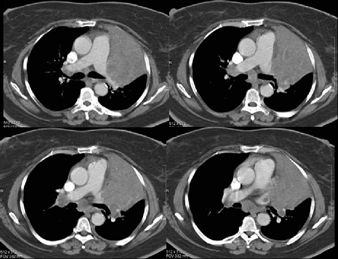 Radiograph 2 from archived case 2