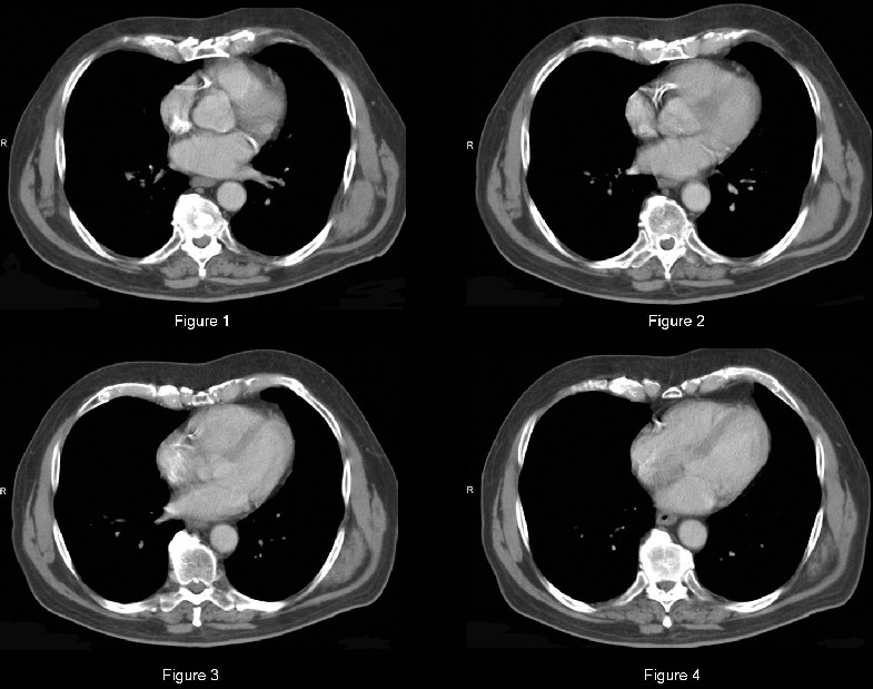 Radiograph 1 from archived case 6