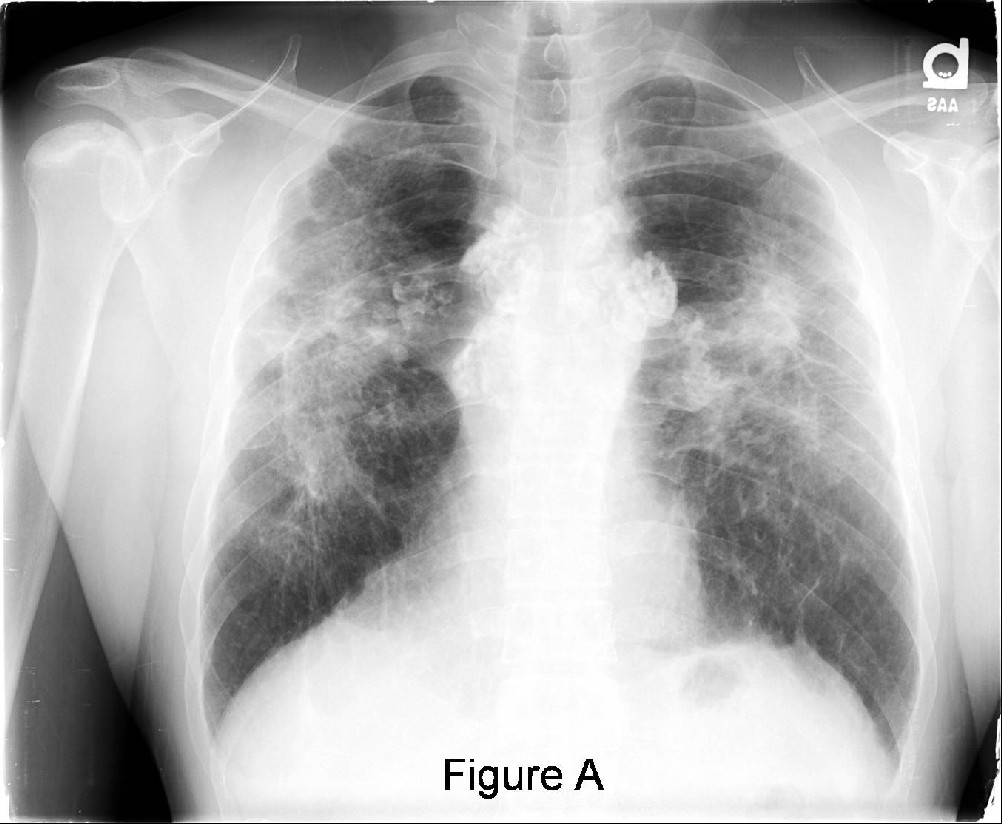 Radiograph 2 from archived case 21
