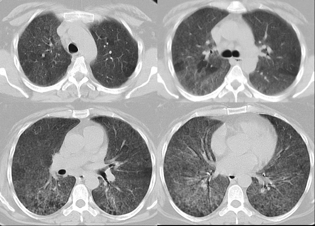 Radiograph 1 from archived case 22