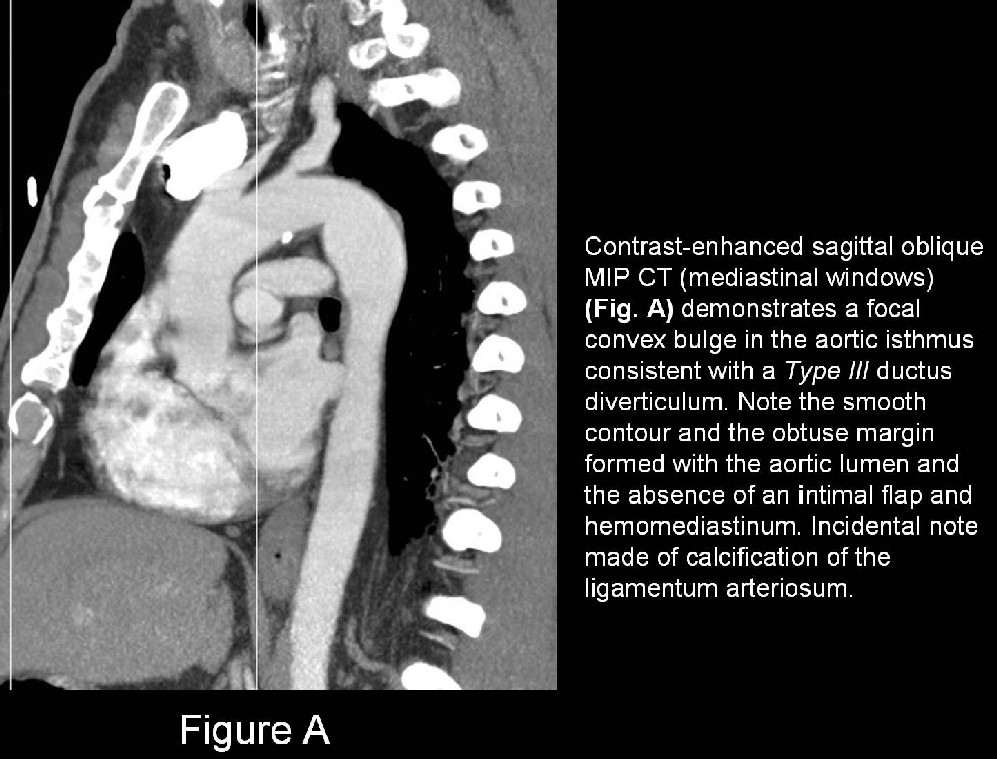 Radiograph 2 from archived case 17