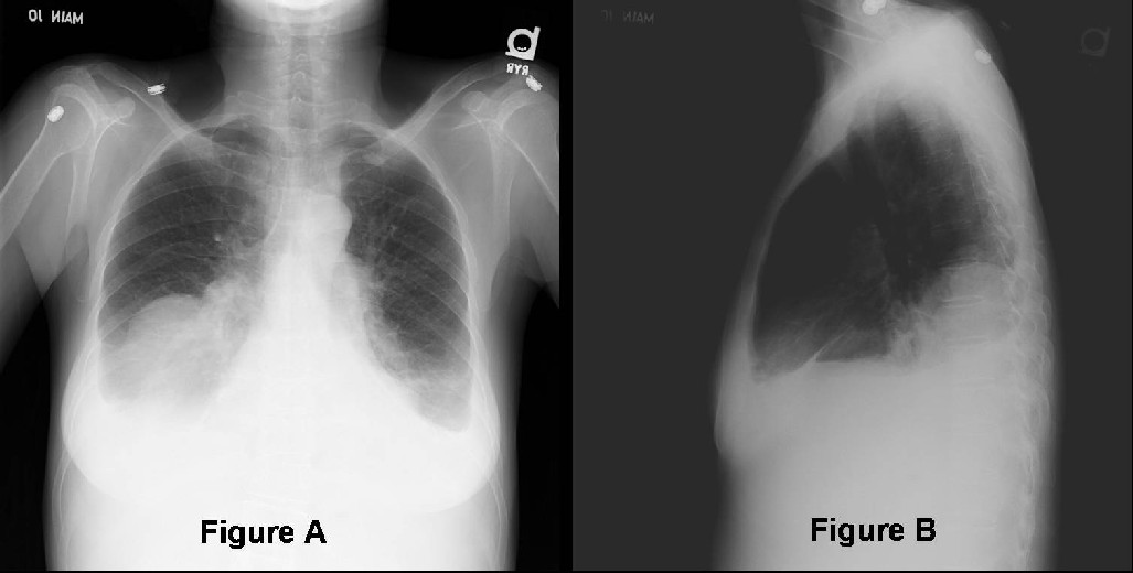 Radiograph 3 from archived case 32