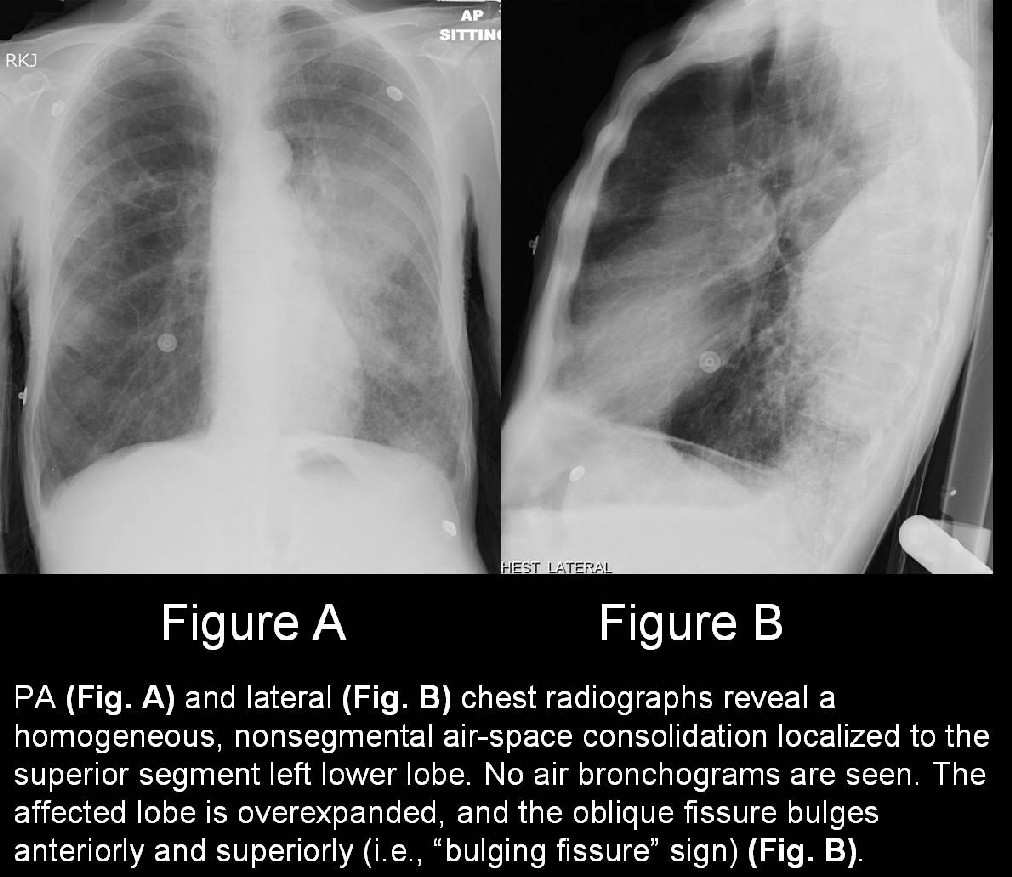Radiograph 2 from archived case 13