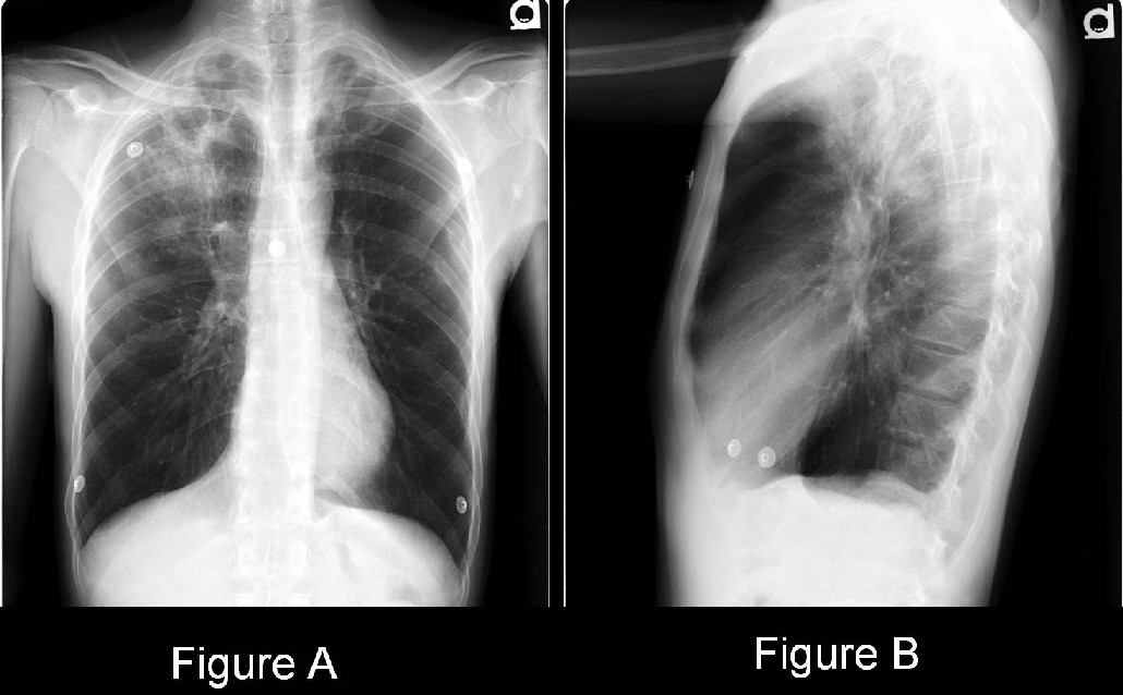 Radiograph 2 from archived case 16