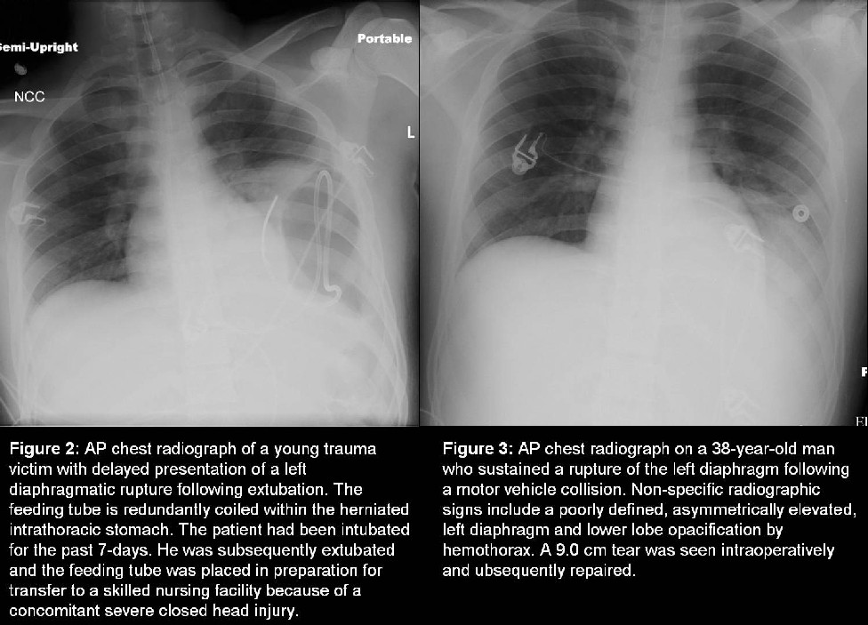 Radiograph 2 from archived case 8