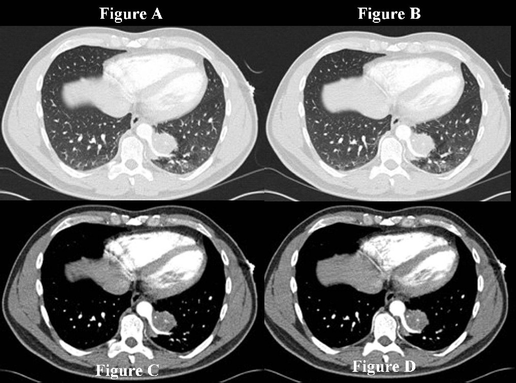 Radiograph 4 from archived case 18