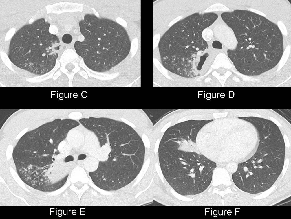 Radiograph 3 from archived case 48