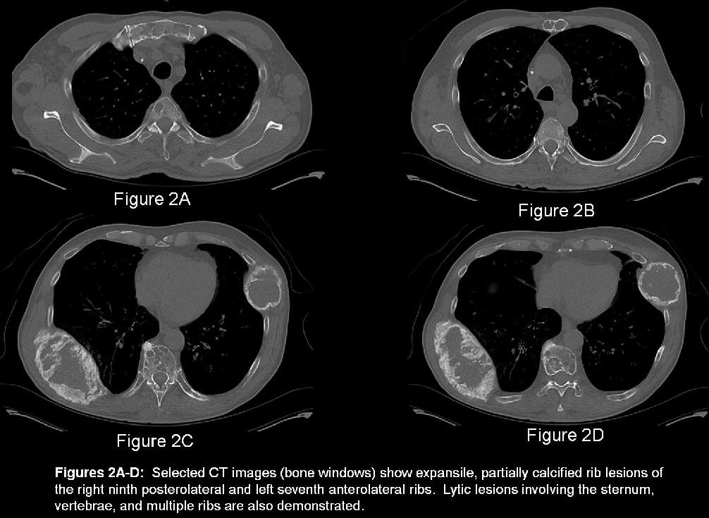 Radiograph 3 from archived case 9