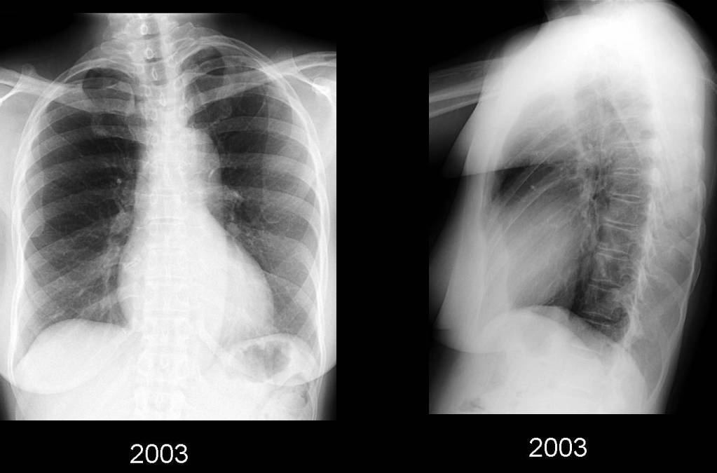 Radiograph 1 from archived case 49