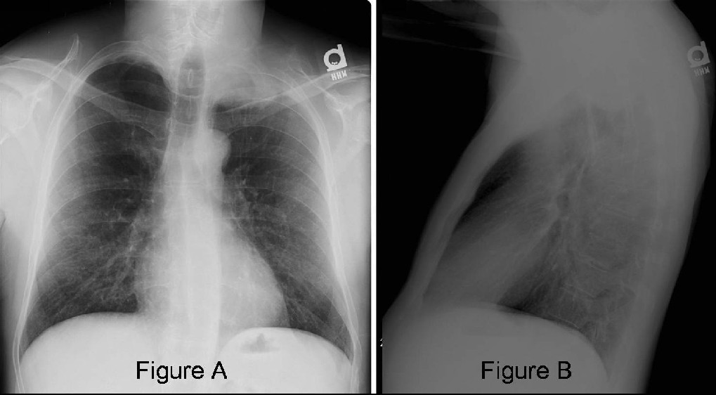 Radiograph 1 from archived case 28