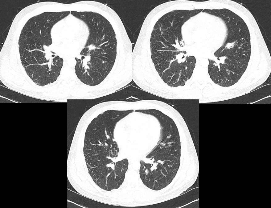 Radiograph 1 from archived case 4