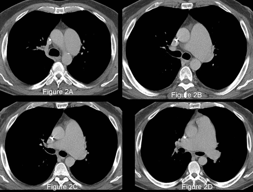 Radiograph 3 from archived case 83
