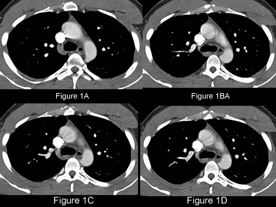 Radiograph 1 from archived case 66