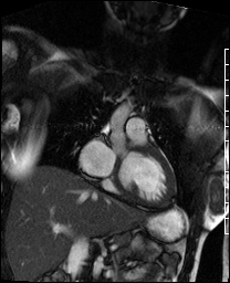 Radiograph 2 from archived case 72