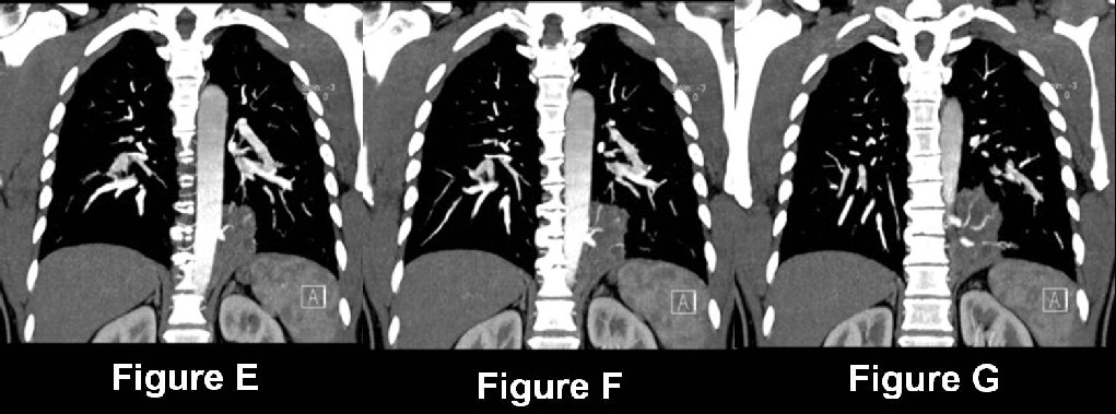 Radiograph 2 from archived case 18