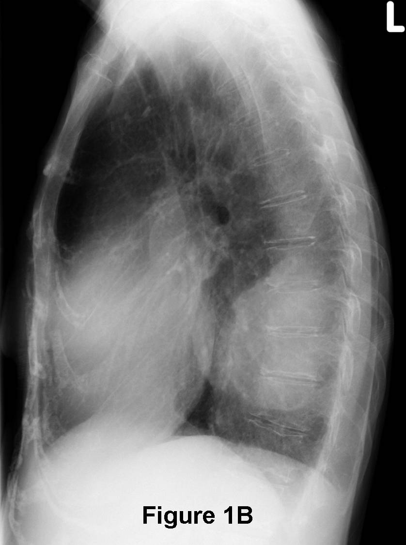 Radiograph 2 from archived case 78