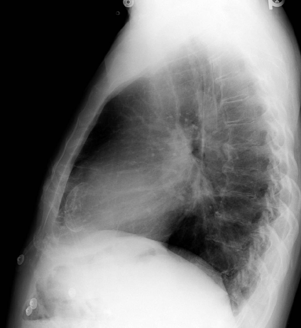 Radiograph 2 from archived case 10