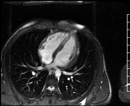 Radiograph 2 from archived case 73