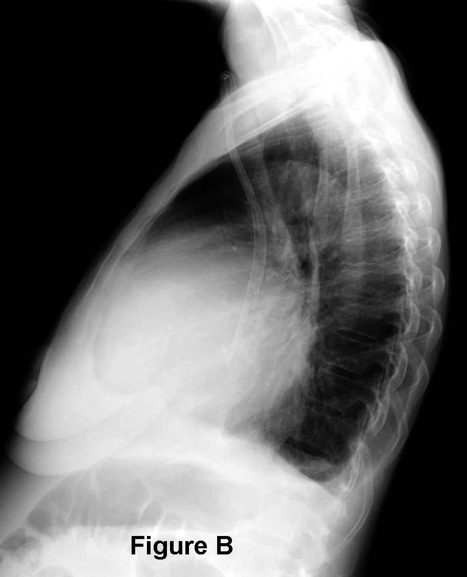 Radiograph 2 from archived case 52