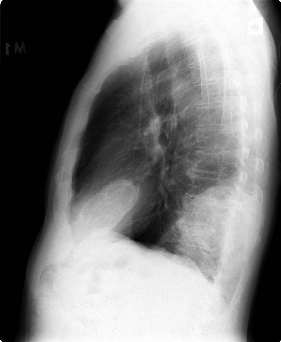 Radiograph 2 from archived case 9
