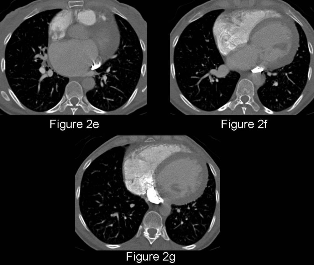 Radiograph 4 from archived case 75