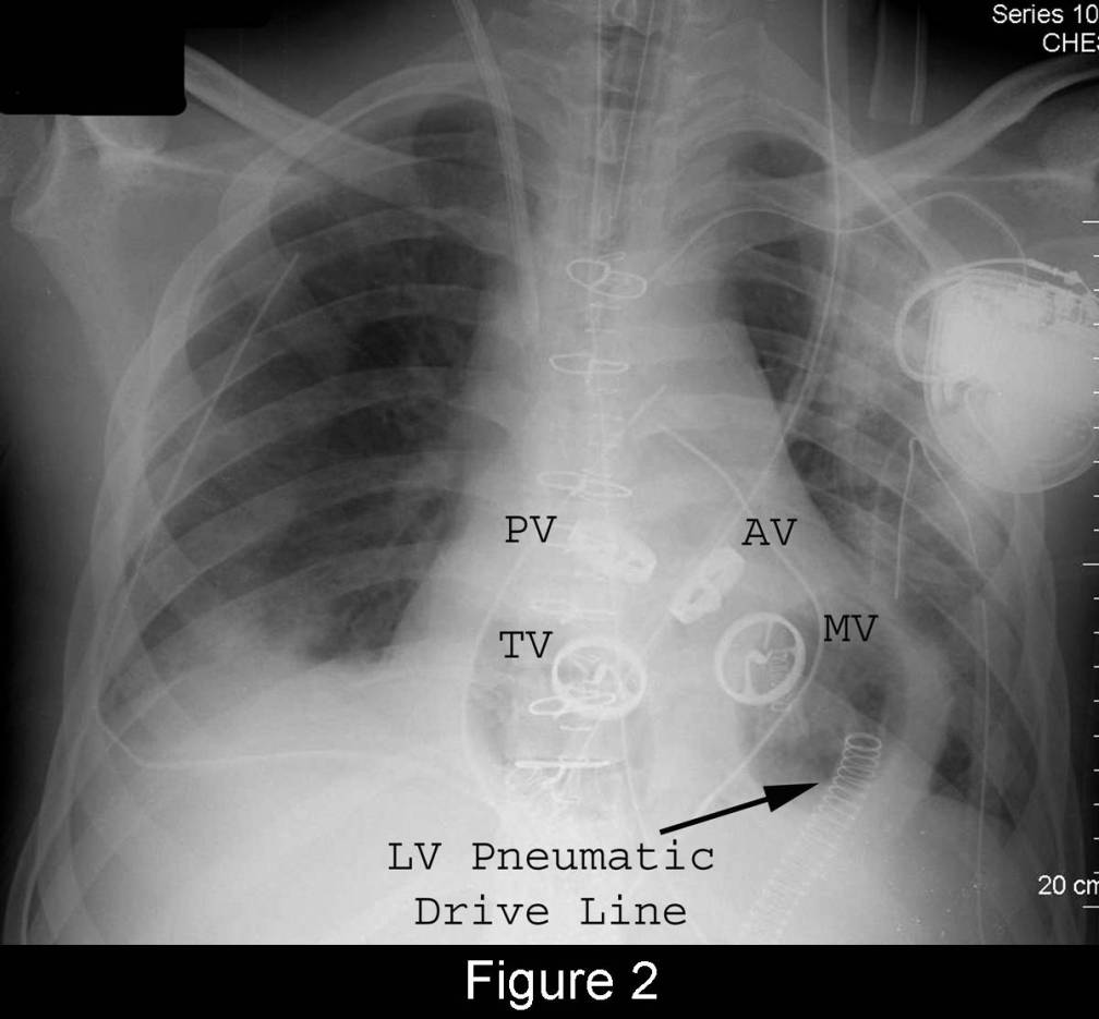 Radiograph 3 from archived case 55