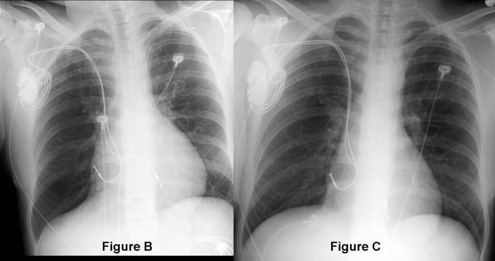 Radiograph 2 from archived case 59