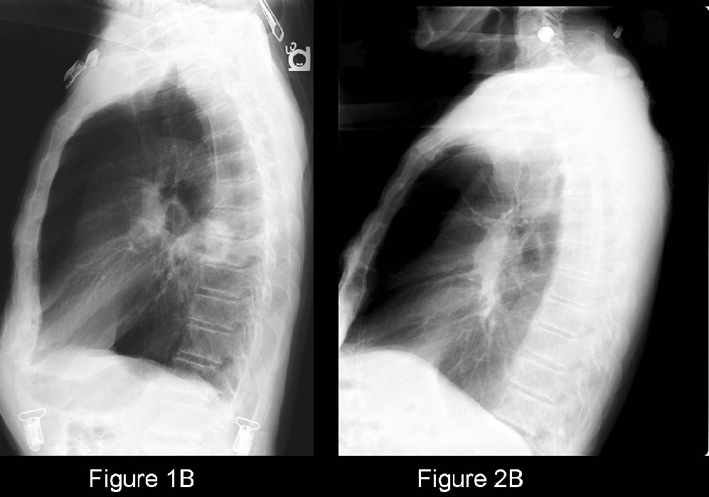 Radiograph 4 from archived case 35