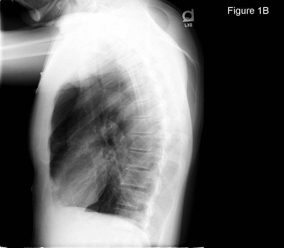 Radiograph 2 from archived case 70