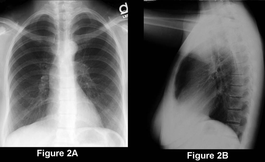Radiograph 2 from archived case 67