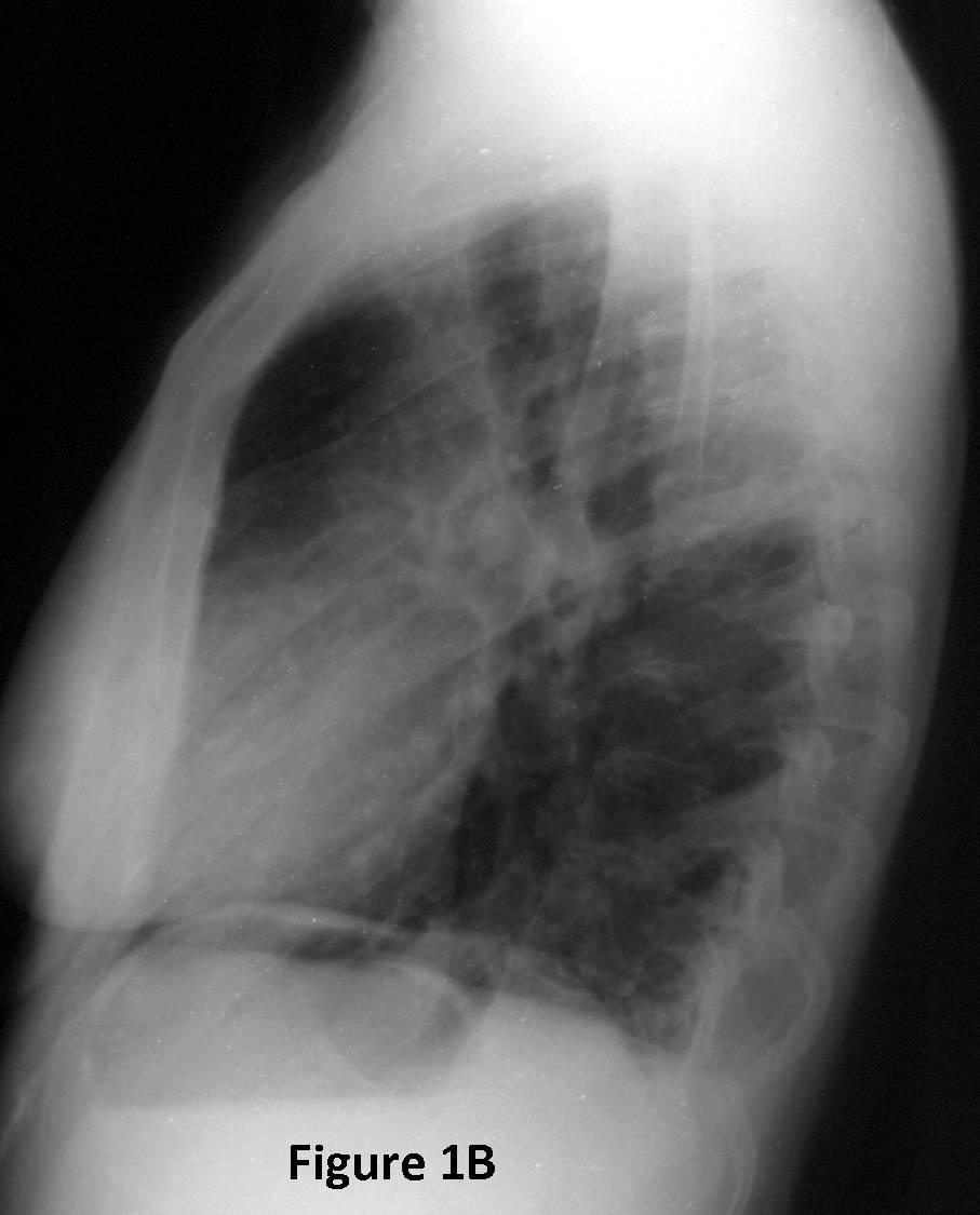 Radiograph 2 from archived case 74